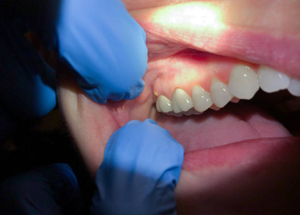 Best Urgent Care for Lost Fillings or Crowns in Preston, IA